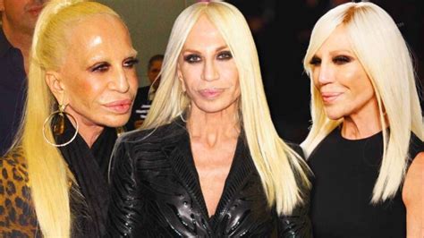 donatella versace al matrimonio di|donatella versace face what happened.